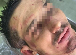 После смерти в рехабе Пятигорска руководители центра стали фигурантами уголовного дела