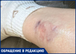 Собаки накинулись и покусали женщину в парке Минераловодского округа