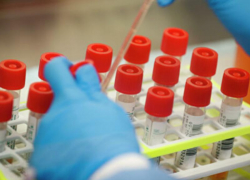 Коронавирусная инфекция унесла жизни 209 ставропольчан