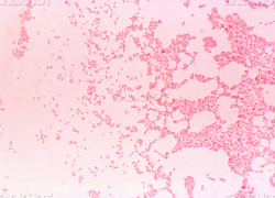 Житель Ставрополья продавал зараженных бруцеллезом животных