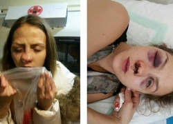 Мужчина из Ессентуков избил молодую москвичку за отказ выйти замуж