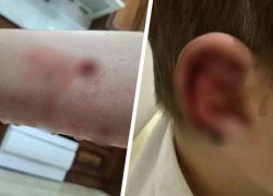 Нападение собак на детей в Минеральных Водах обернулось уголовным делом 