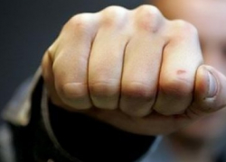 В Ставрополе полицейский подрался с двумя угонщиками и попал в больницу