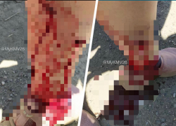 Агрессивная собака покусала жительницу станицы Ессентукской