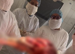 Ставропольские врачи удалили у пациентки гигантскую опухоль весом 17 килограммов 