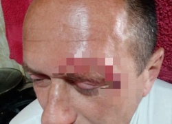 Конфликт между охраной Комсомольского пруда и ставропольцем закончился дракой