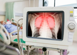 Еще два пациента с коронавирусом умерли на Ставрополье