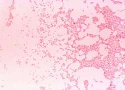 На Ставрополье местный житель продавал животных, болеющих бруцеллезом