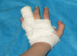 Столкновение с джипом закончилось переломом пальца для ставропольского подростка