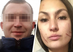 Изуродовал из ревности. Ставрополец напал на возлюбленную с ножом