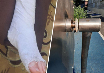 Кричал на всю площадку: качель рухнула на ногу пятилетнему мальчику в Минеральных Водах 