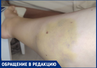 Ужасная боль и шок: беременная ставропольчанка рассказала о ДТП без виновных