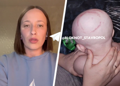 Сломали череп и ключицу: запрещенные методы при родах в ставропольском перинатальном центре окончились травмами младенца