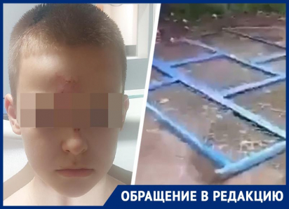 «Весь в крови был»: 10-летнего ребенка в Ставрополе придавило ограждением детской площадки 
