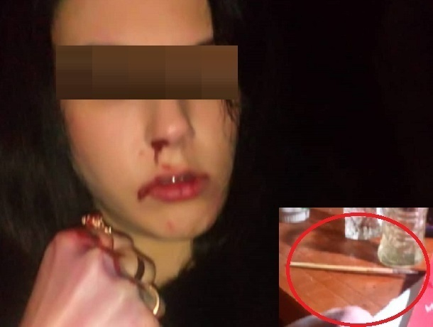 «А на столе кисточка»: в кровавое избиение девушки тремя парнями не поверили жители Кисловодска