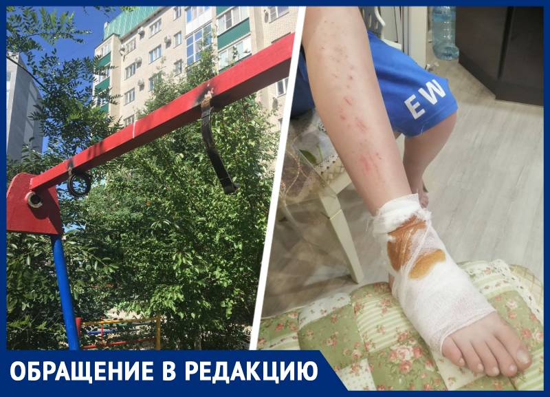 Металлические качели рухнули ребенку на ногу в Ставрополе