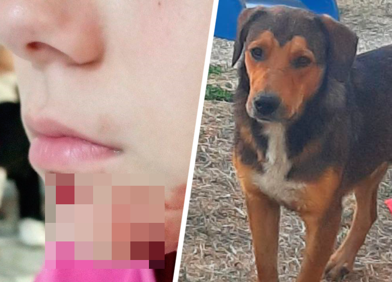 «Прохожие никак не отреагировали»: собака напала на 10-летнюю девочку в военном городке Ставрополя
