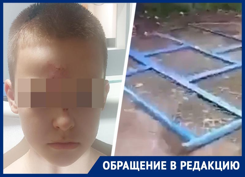 «Весь в крови был»: 10-летнего ребенка в Ставрополе придавило ограждением детской площадки
