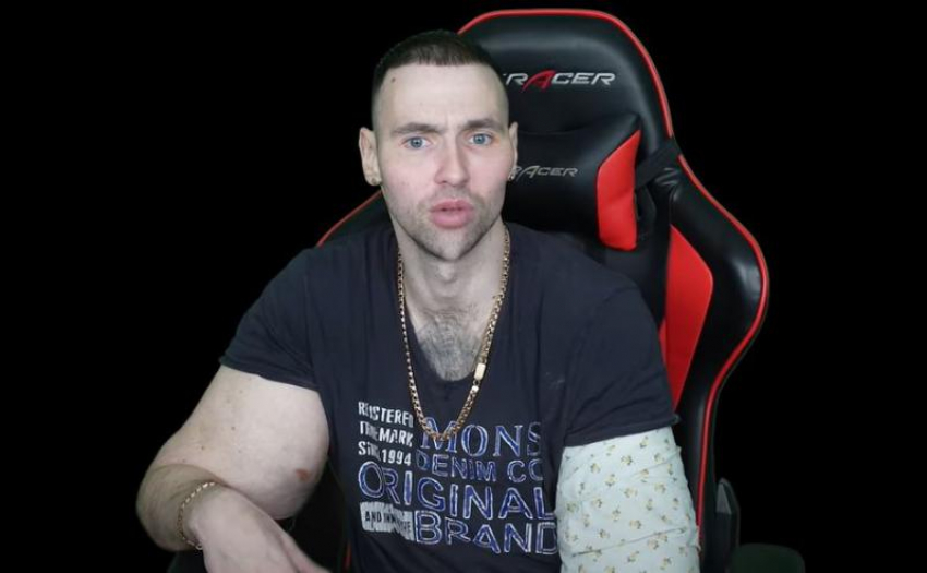 Фрик-блогер из Пятигорска Руки базуки убрал филлеры с лица и планирует пересадку кожи