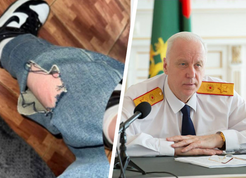 Бастрыкин потребовал отчет по делу о нападении собак на женщину в Пятигорске 