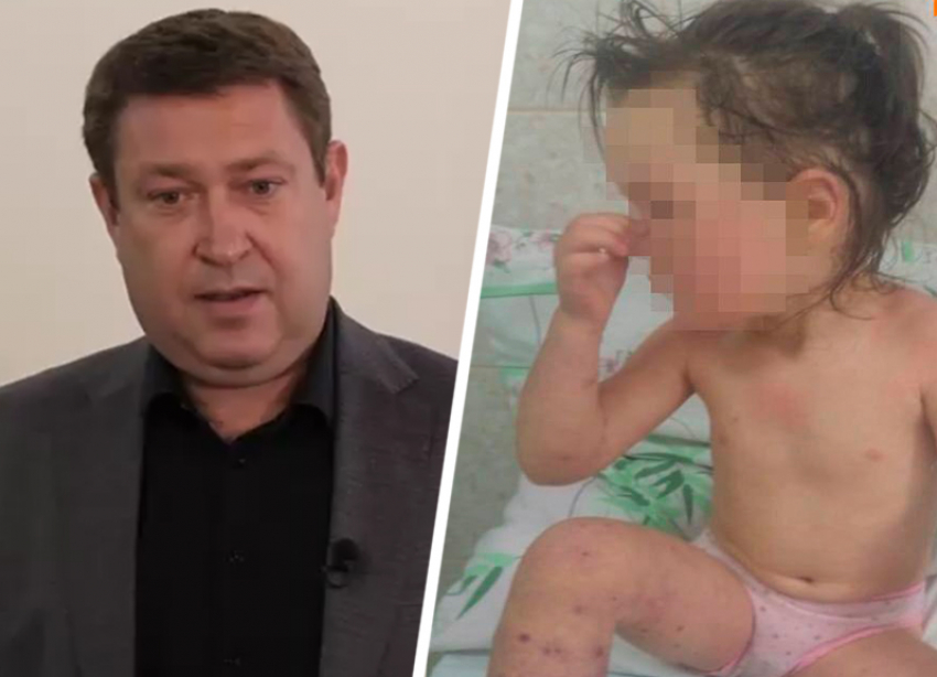 Родители скончавшейся от менингита 4-летней девочки получили соболезнования от главы минздрава Ставрополья 
