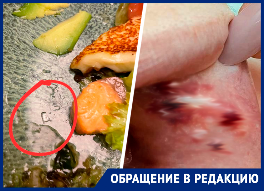 Стекло в салате и порезанная изнутри щека: горожанка пожаловалась на рестобар в Ставрополе