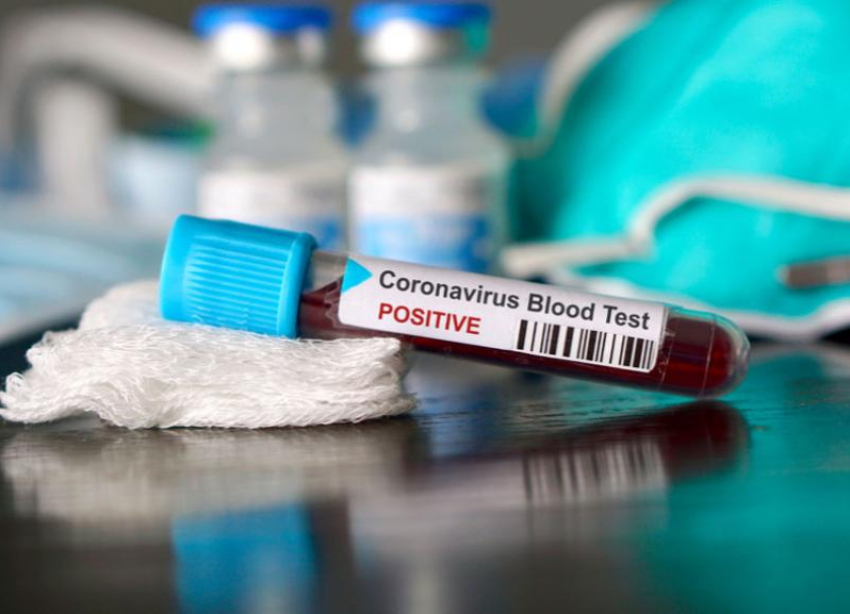 Еще у 85 ставропольцев выявили коронавирус