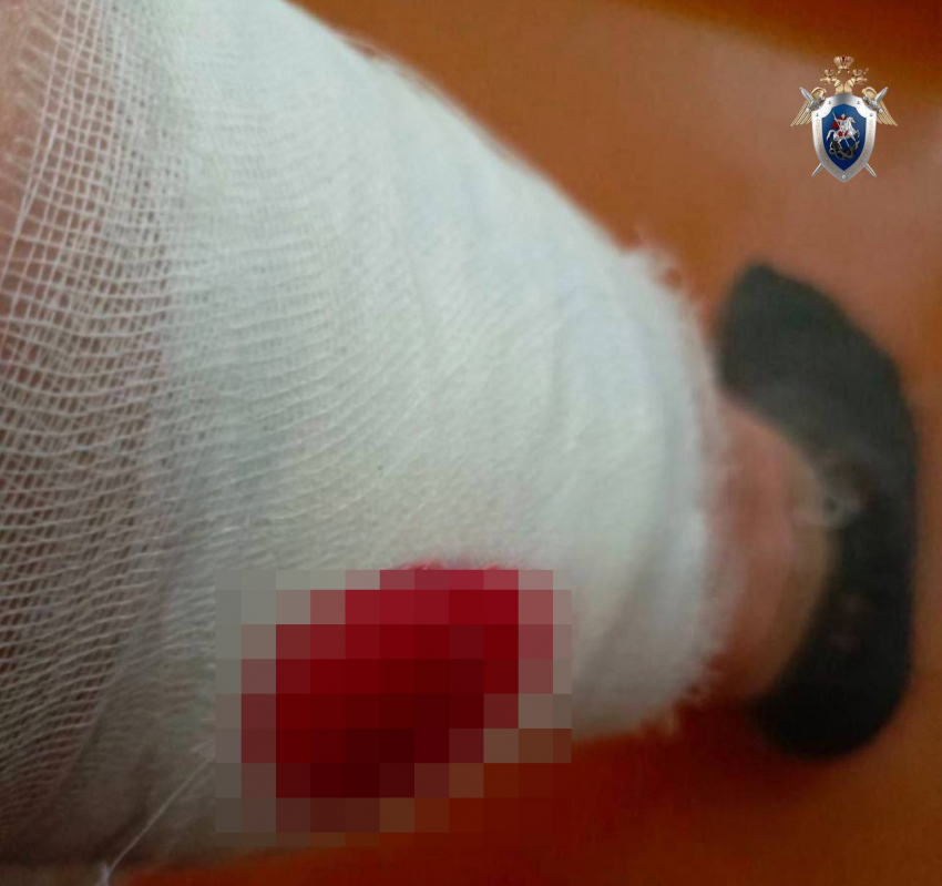 Нападение стаи собак на женщину в Минводах стало поводом для уголовного дела