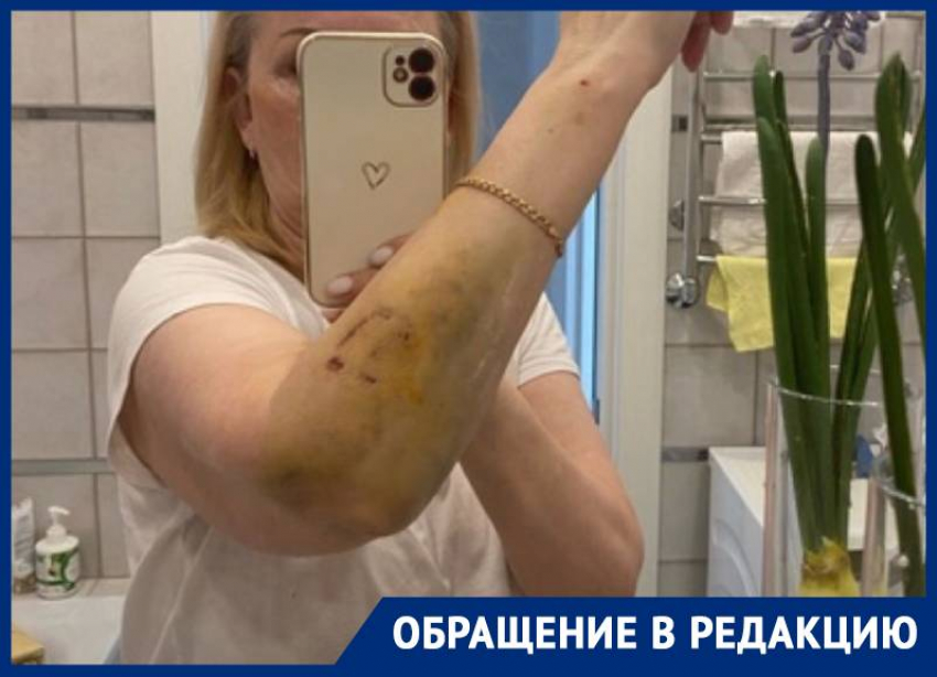 «Нечего было махать руками»: жительниц Ставрополя покусала собака без поводка и намордника