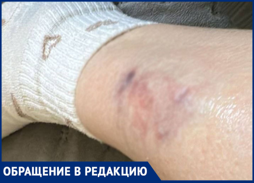 Собаки накинулись и покусали женщину в парке Минераловодского округа