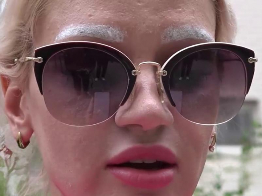 Сочащиеся брови и воспаление: поход к косметологу с сайта объявлений обернулся угрозами для ставропольчанки