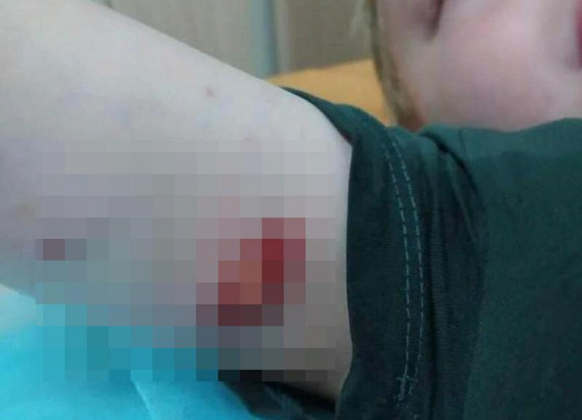 Агрессивная собака покусала пятилетнего ребенка на детской площадке в Михайловске