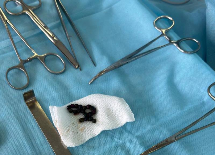 В Ставрополе из кишечника трехлетнего мальчика вытащили 18 магнитов 