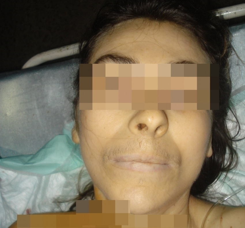 Полиция МинВод просит помочь опознать труп упавшей с 9 этажа женщины