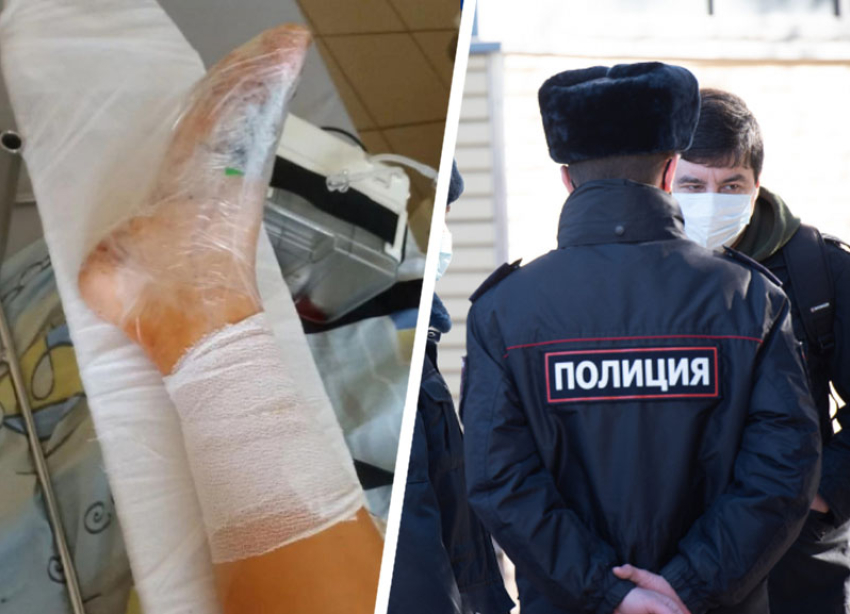После ДТП с пострадавшей девочкой на Ставрополье полиция начала проверку