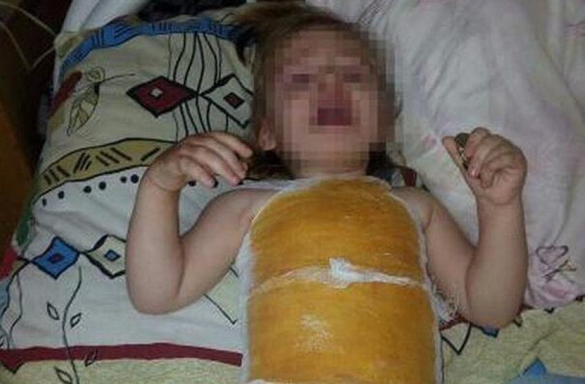 Двухлетняя девочка получила ожоги в детском саду Буденновска