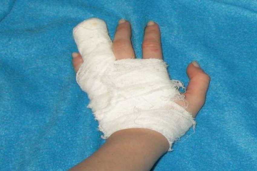 Столкновение с джипом закончилось переломом пальца для ставропольского подростка
