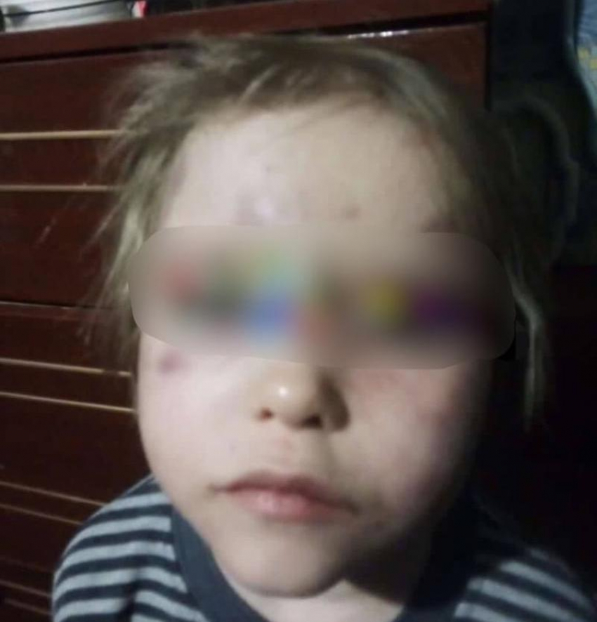 Истязавшего 3-летнюю девочку отца арестовали на Ставрополье