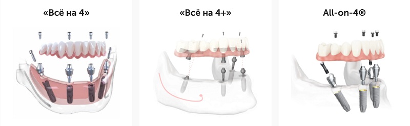 ст2.jpg